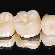 дешевое протезирование зубов
